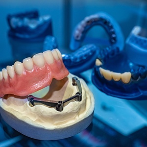 Example of implant dentures from Jupiter Family Dental of Richardson