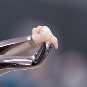 We accept a variety of convenient payment options for patients who need tooth extraction