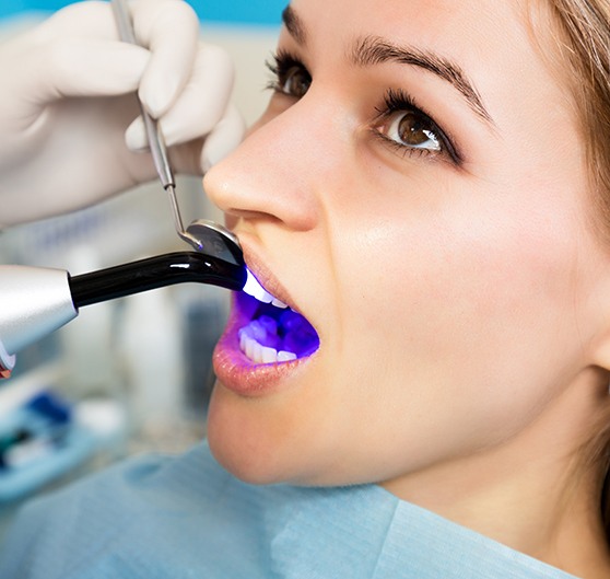 There are many benefits to tooth-colored fillings